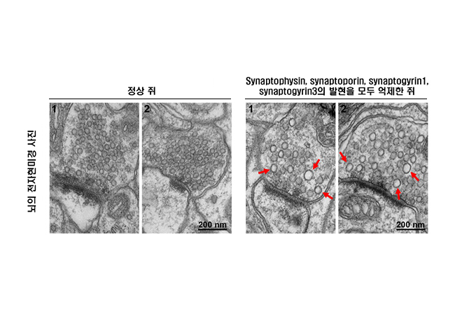 Professor Park Dae-hoon's Research Team Discovers Neurotransmitter Vesicles in Brain