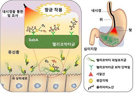 Development of Helicobacter Eradication Therapy through Light