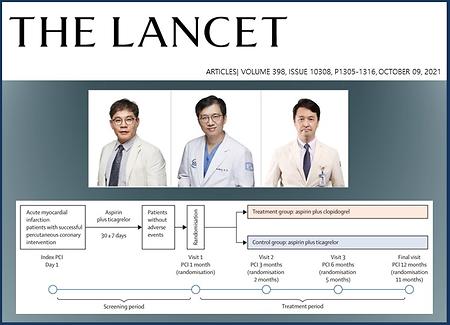 A New Treatment Developed to Dramatically Reduce the Mortality Rate after Acute Myocardial Infarction Stent