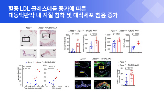 The Catholic University of Korea Professor Lee Hyeok's joint research team identifies the early progression mechanism of