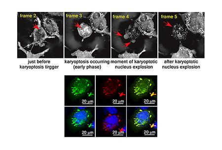 Pharmaceutical Sciences Professor Yong-Yeon Cho's Research Team Discovers Novel Cell Death Pathway