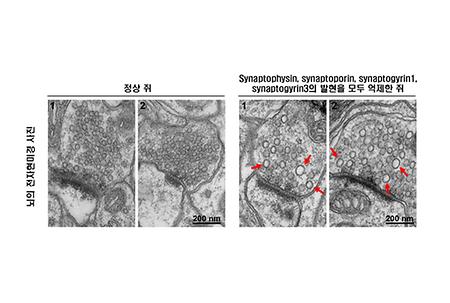 Professor Park Dae-hoon's Research Team Discovers Neurotransmitter Vesicles in Brain