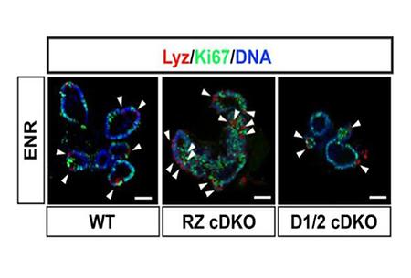 Professor Ji-hoon Kim at the CUK identifies the likelihood of tumor development through Daam proteins