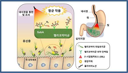 빛을 통한 헬리코박터균 제거 치료법 개발