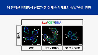 김지훈 교수,  담 단백질을 통한 종양 유발 가능성 규명