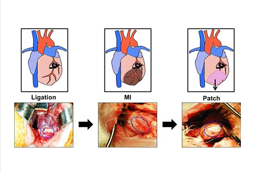 가톨릭대 의대 전흥재 교수팀, 심장 조직 재생 위한 신규 패치 개발
